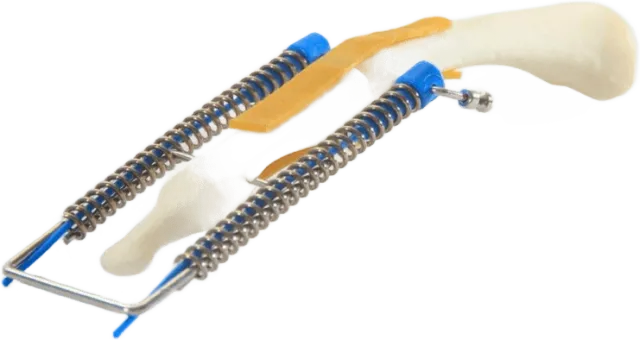 Ligamentotaxor · FingerFix · foto 2