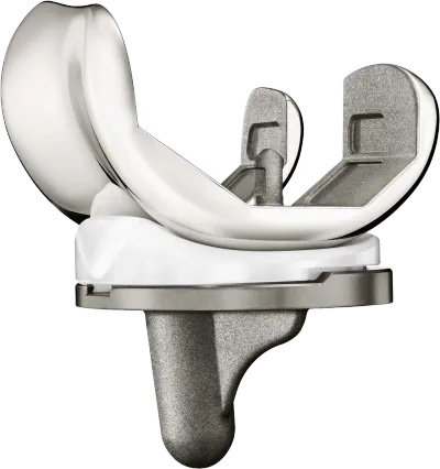 Origin · Knee System