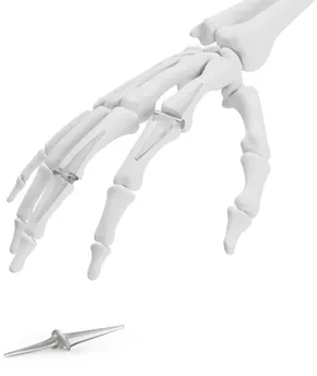 Binnenkort leverbaar Silicone Finger Implant voor MCP en PIP